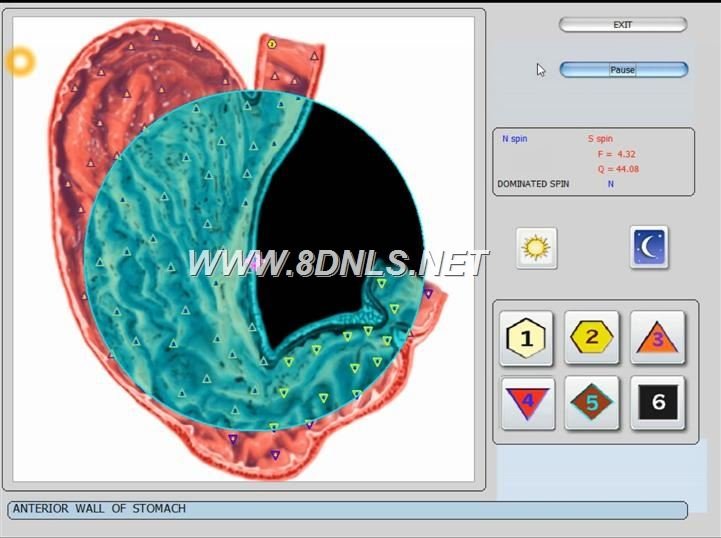 Metatron Hunter 4025 NLS