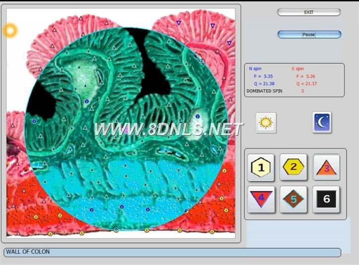 Metatron Hunter 4025 NLS