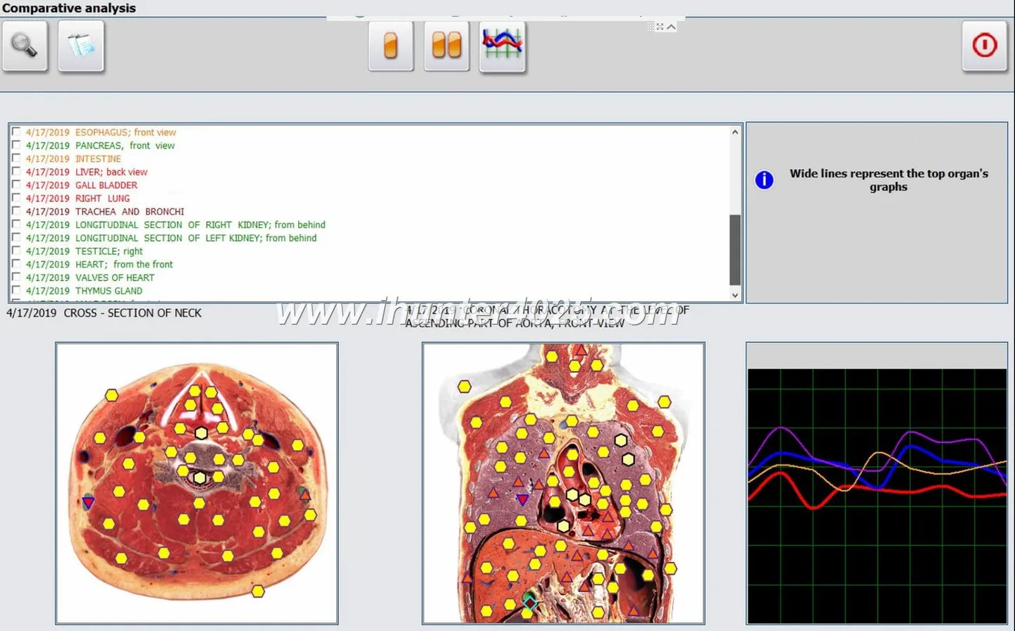 Metatron hunter 4025 nls analyzer MK-018 — MAIKONG Hunter 4025 Metatron (4968).JPG